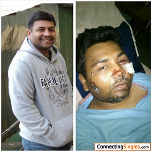 Before and after the accident